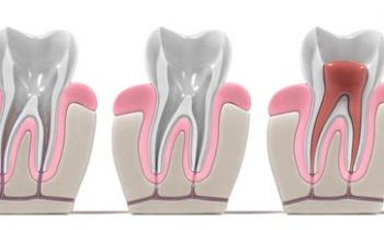 koreninsko zdravljenje