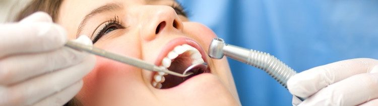 zobne zalivke zobne zalivke